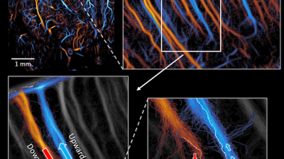 capillary ULM small