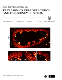 IEEE TUFFC cover image super-res